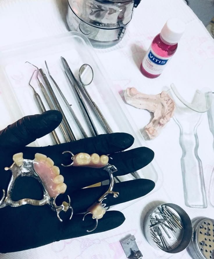 Rehabilitación Oral