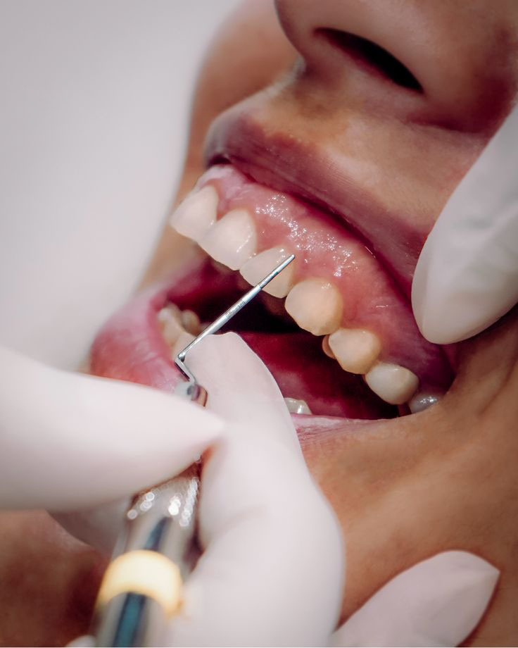 Periodoncia